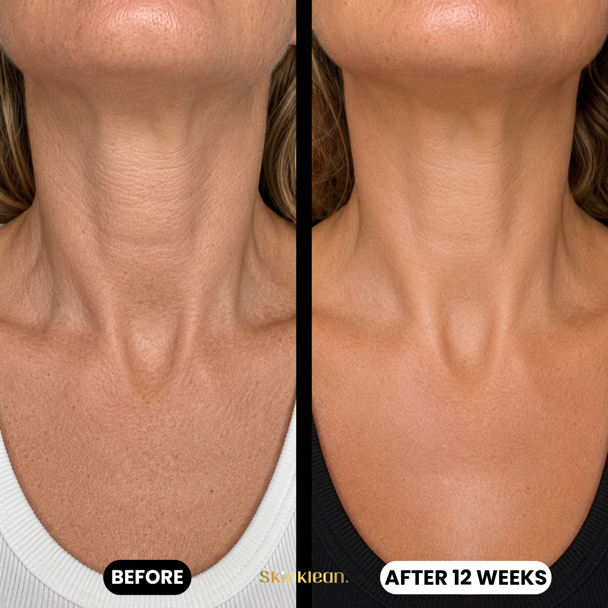 Baby Collagen DÉCOLLETÉ Mask