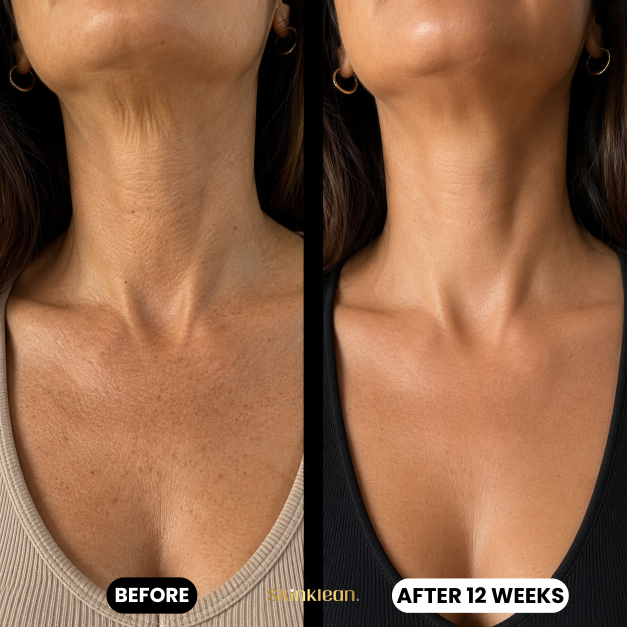 Baby Collagen DÉCOLLETÉ Mask