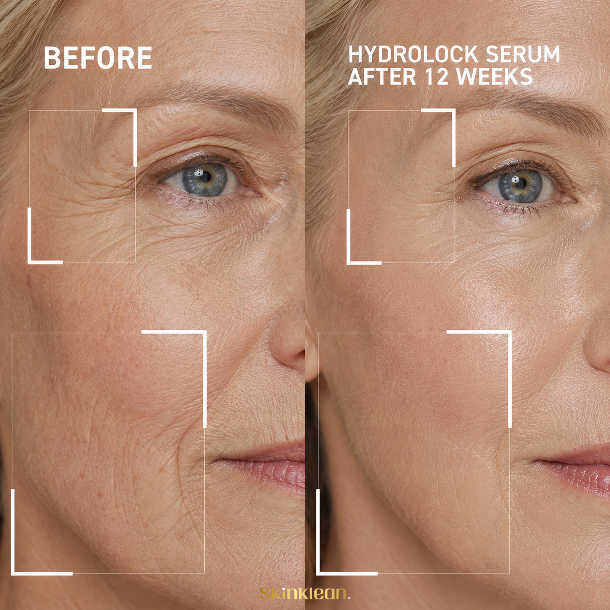 Hyaluronic Acid Serum