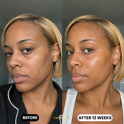 Hyaluronic Acid Serum