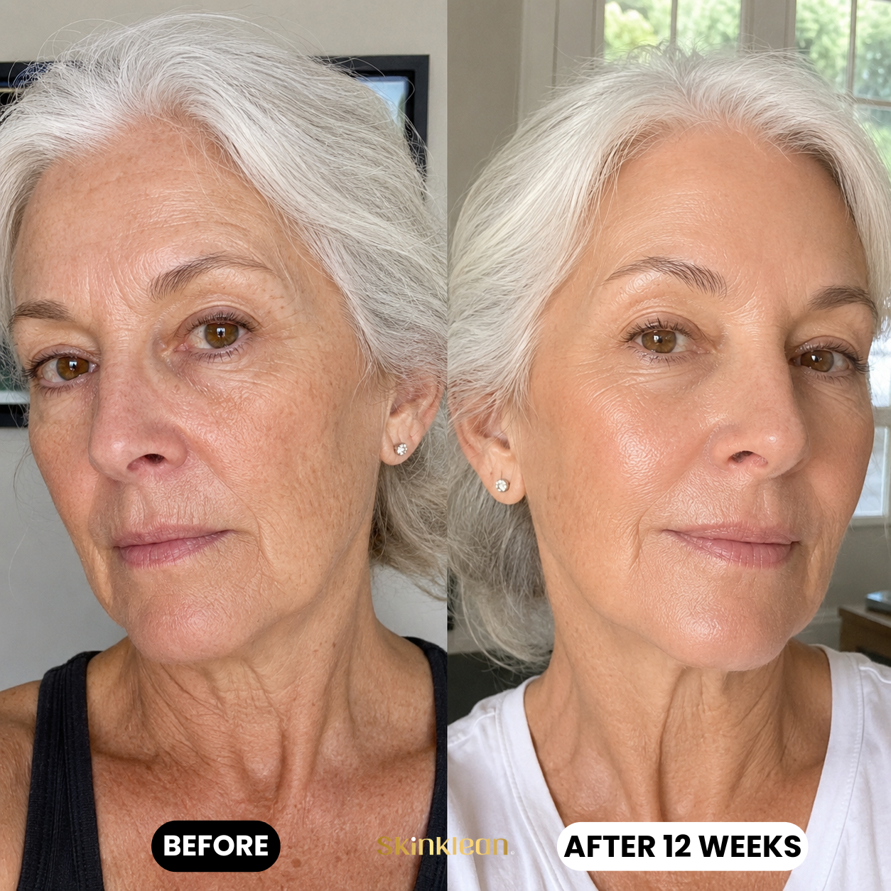 Hyaluronic Acid Serum