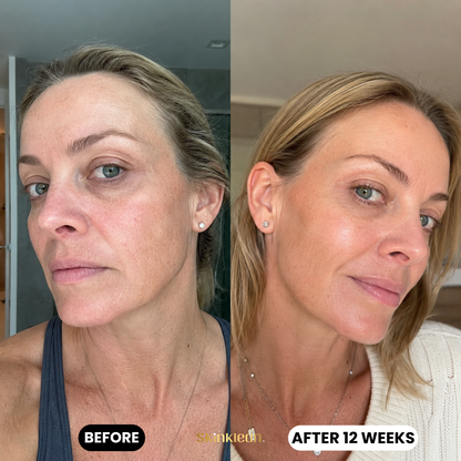 Hyaluronic Acid Serum