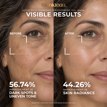 Kojic Acid Turmeric® Brightening Gel Mask